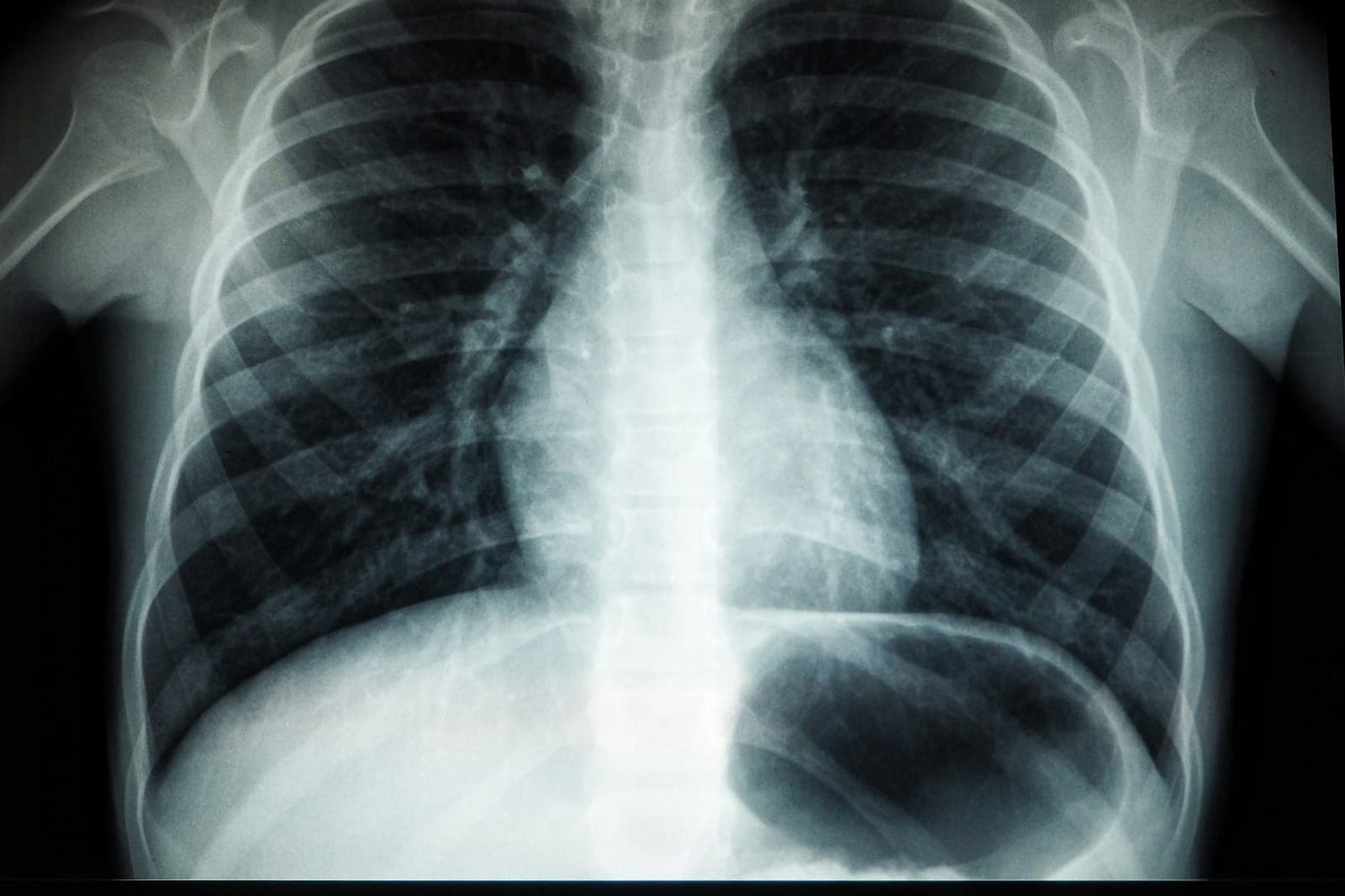 Radiology medical billing services