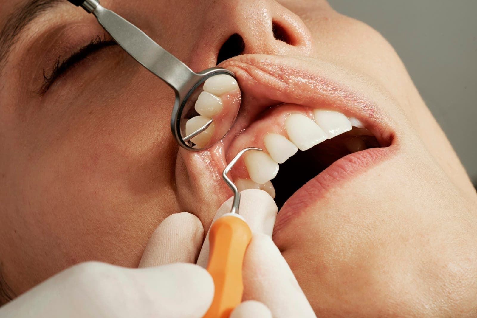 Dental Billing medical billing services